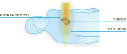 traditional radiation